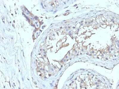 Immunohistochemistry-Paraffin: CD63 Antibody (NKI/C3 + LAMP3/968) - IHC-Prediluted [NBP2-48022]