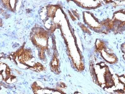 Immunohistochemistry-Paraffin: CD63 Antibody (NKI/C3 + LAMP3/968) - IHC-Prediluted [NBP2-48022]