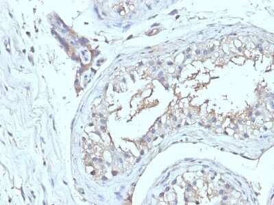 Immunohistochemistry-Paraffin: CD63 Antibody (NKI/C3 + LAMP3/968) [NBP2-44811]