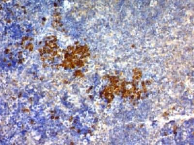 Immunohistochemistry-Paraffin: CD63 Antibody (NKI/C3) - Azide and BSA Free [NBP2-34694]