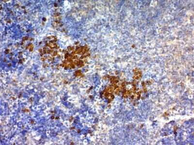 Immunohistochemistry-Paraffin: CD63 Antibody (NKI/C3) - IHC-Prediluted [NBP2-44806]