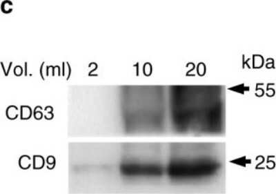 Western Blot: CD63 Antibody (NKI/C3) [NBP2-32829]