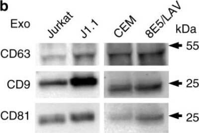 Western Blot: CD63 Antibody (NKI/C3) [NBP2-32829]