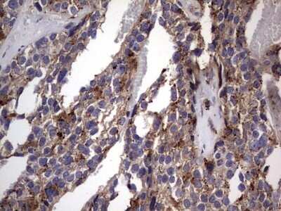 Immunohistochemistry: CD63 Antibody (OTI5E5) - Azide and BSA Free [NBP2-70380]