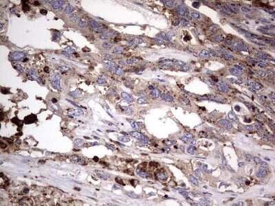 Immunohistochemistry: CD63 Antibody (OTI5E5) - Azide and BSA Free [NBP2-70380]