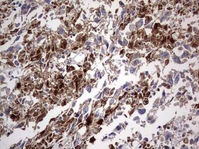 Immunohistochemistry: CD63 Antibody (OTI5E5) - Azide and BSA Free [NBP2-70380]