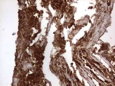 Immunohistochemistry: CD63 Antibody (OTI5E5) - Azide and BSA Free [NBP2-70380]