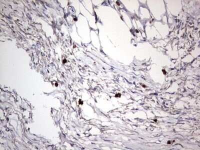 Immunohistochemistry: CD63 Antibody (OTI5E5) - Azide and BSA Free [NBP2-70380]
