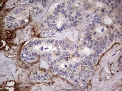 Immunohistochemistry: CD63 Antibody (OTI5E5) - Azide and BSA Free [NBP2-70380]