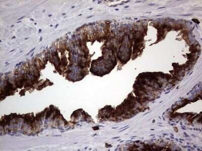 Immunohistochemistry: CD63 Antibody (OTI5E5) - Azide and BSA Free [NBP2-70380]