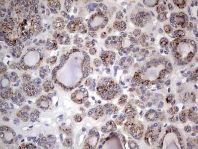 Immunohistochemistry: CD63 Antibody (OTI5E5) - Azide and BSA Free [NBP2-70380]