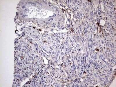 Immunohistochemistry: CD63 Antibody (OTI5E5) - Azide and BSA Free [NBP2-70380]