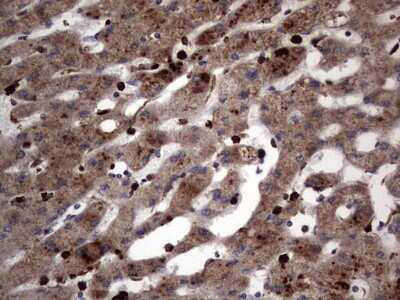 Immunohistochemistry: CD63 Antibody (OTI5E5) - Azide and BSA Free [NBP2-70380]