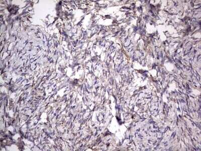 Immunohistochemistry: CD63 Antibody (OTI5E5) - Azide and BSA Free [NBP2-70380]