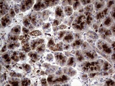 Immunohistochemistry: CD63 Antibody (OTI5E5) - Azide and BSA Free [NBP2-70380]