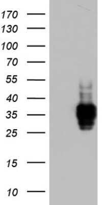 Western Blot: CD63 Antibody (OTI5E5)Azide and BSA Free [NBP2-70380]