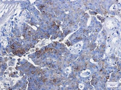 Immunohistochemistry-Paraffin: CD63 Antibody (S08-7C9) [NBP3-20035]
