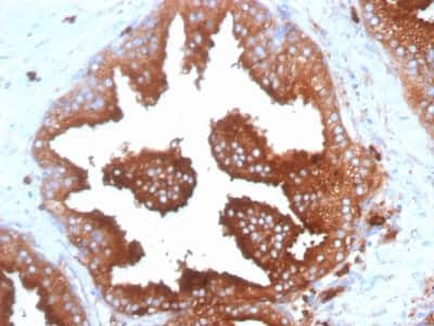 Immunohistochemistry-Paraffin: CD63 Antibody (SPM524) [NBP2-32943]