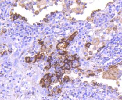 Immunohistochemistry-Paraffin: CD63 Antibody (SY21-02) [NBP2-67425]