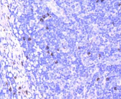Immunohistochemistry-Paraffin: CD63 Antibody (SY21-02) [NBP2-67425]
