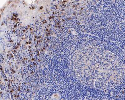 Immunohistochemistry-Paraffin: CD63 Antibody (SY21-02) [NBP2-67425]