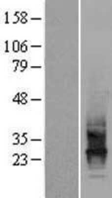 Western Blot: CD63 Overexpression Lysate [NBL1-08960]