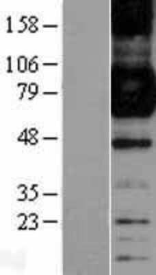 Western Blot: Fc gamma RI/CD64 Overexpression Lysate [NBL1-10654]