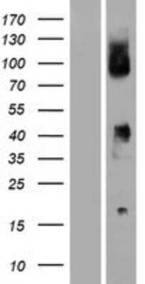 Western Blot: CD64/FCGR1B Overexpression Lysate [NBP2-10606]