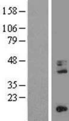 Western Blot: CD68/SR-D1 Overexpression Lysate [NBL1-08962]