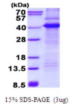 SDS-PAGE: Recombinant Human CD68/SR-D1 His Protein [NBP2-22756]