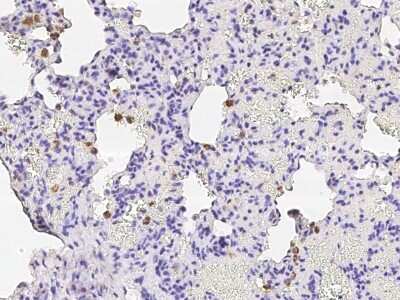 Immunohistochemistry-Paraffin: CD68/SR-D1 Antibody (001) [NBP2-90914]