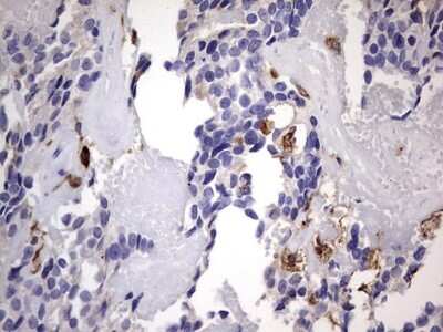 Immunohistochemistry: CD68/SR-D1 Antibody (OTI1E6) [NBP2-46168]
