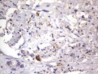 Immunohistochemistry: CD68/SR-D1 Antibody (OTI1E6) [NBP2-46168]