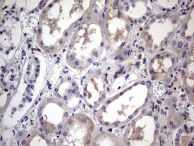 Immunohistochemistry: CD68/SR-D1 Antibody (OTI1E6) [NBP2-46168]