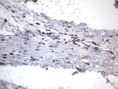 Immunohistochemistry: CD68/SR-D1 Antibody (OTI1E6) [NBP2-46168]