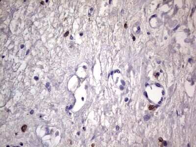 Immunohistochemistry: CD68/SR-D1 Antibody (OTI1E6) [NBP2-46168]