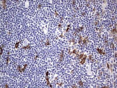 Immunohistochemistry: CD68/SR-D1 Antibody (OTI1E6) [NBP2-46168]