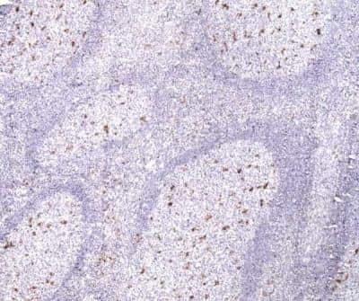 Immunohistochemistry-Paraffin: CD68/SR-D1 Antibody (514H12) [NB100-65101]