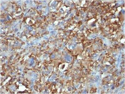 Immunohistochemistry-Paraffin: CD68/SR-D1 Antibody (C68/684) - Azide and BSA Free [NBP2-34587]