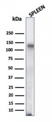 Western Blot: CD68/SR-D1 Antibody (C68/684) [NBP2-32832]