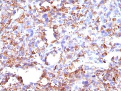 Immunohistochemistry-Paraffin: CD68/SR-D1 Antibody (CD68/G2) - IHC-Prediluted [NBP2-48025]