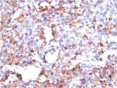 Immunohistochemistry-Paraffin: CD68/SR-D1 Antibody (CD68/G2) [NBP2-44544]