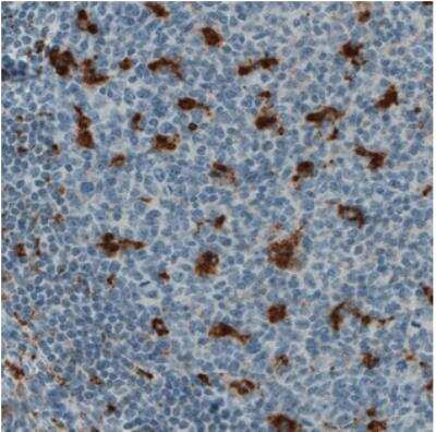 Immunohistochemistry: CD68/SR-D1 Antibody (CL1346) [NBP2-34482]