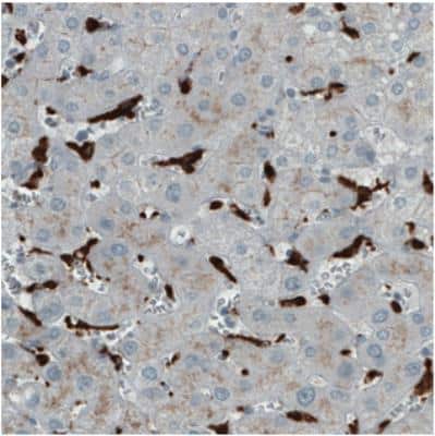 Immunohistochemistry: CD68/SR-D1 Antibody (CL1346) [NBP2-34482]