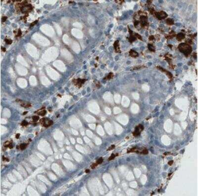 Immunohistochemistry: CD68/SR-D1 Antibody (CL1346) [NBP2-34482]