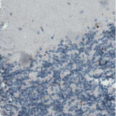 Immunohistochemistry: CD68/SR-D1 Antibody (CL1346) [NBP2-34482]