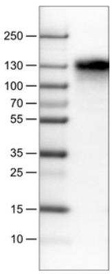 Western Blot: CD68/SR-D1 Antibody (CL1346) [NBP2-34482]