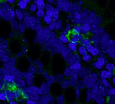Immunohistochemistry-Frozen: CD68/SR-D1 Antibody (ED1) - BSA Free [NB600-985]
