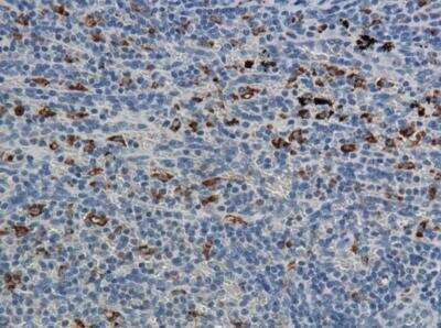 Immunohistochemistry-Paraffin: CD68/SR-D1 Antibody (ED1) - BSA Free [NB600-985]