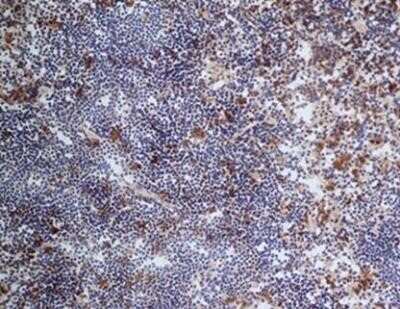 Immunohistochemistry: CD68/SR-D1 Antibody (FA-11) - Azide and BSA Free [NBP2-80656]